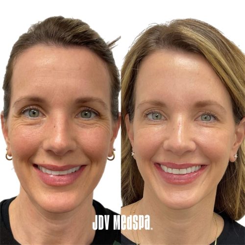 Bazaart_0D2C2257-8F03-4152-B939-45682BFDE5F1 (1)