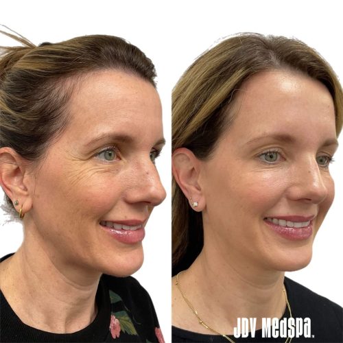 Bazaart_DA66DFEF-05FA-4858-A794-3C4507E3B368 (1)