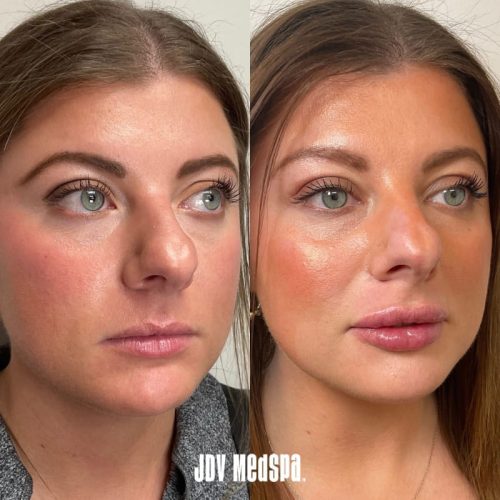 Before-After-March-04