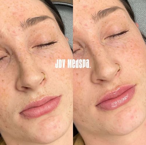 Before-After-March-05