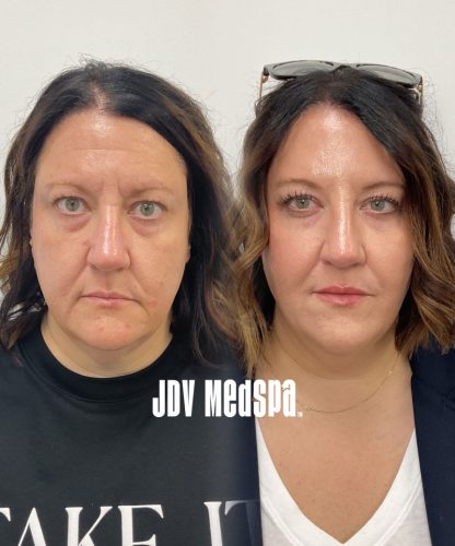 Combination-Treatments