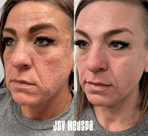 Customized-Combination-Treatment