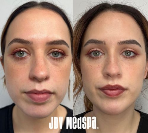 Facial-Balancing