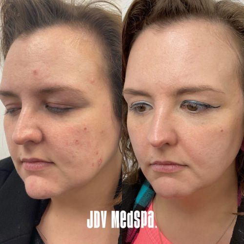 Halo-BBL-Customized-Skin