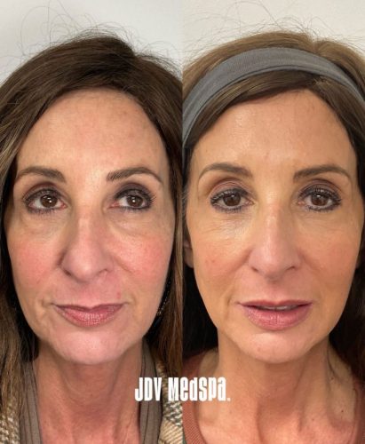 JDV-Customized-Combination-Treatments