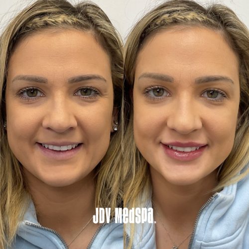 before-and-after-12-23-24